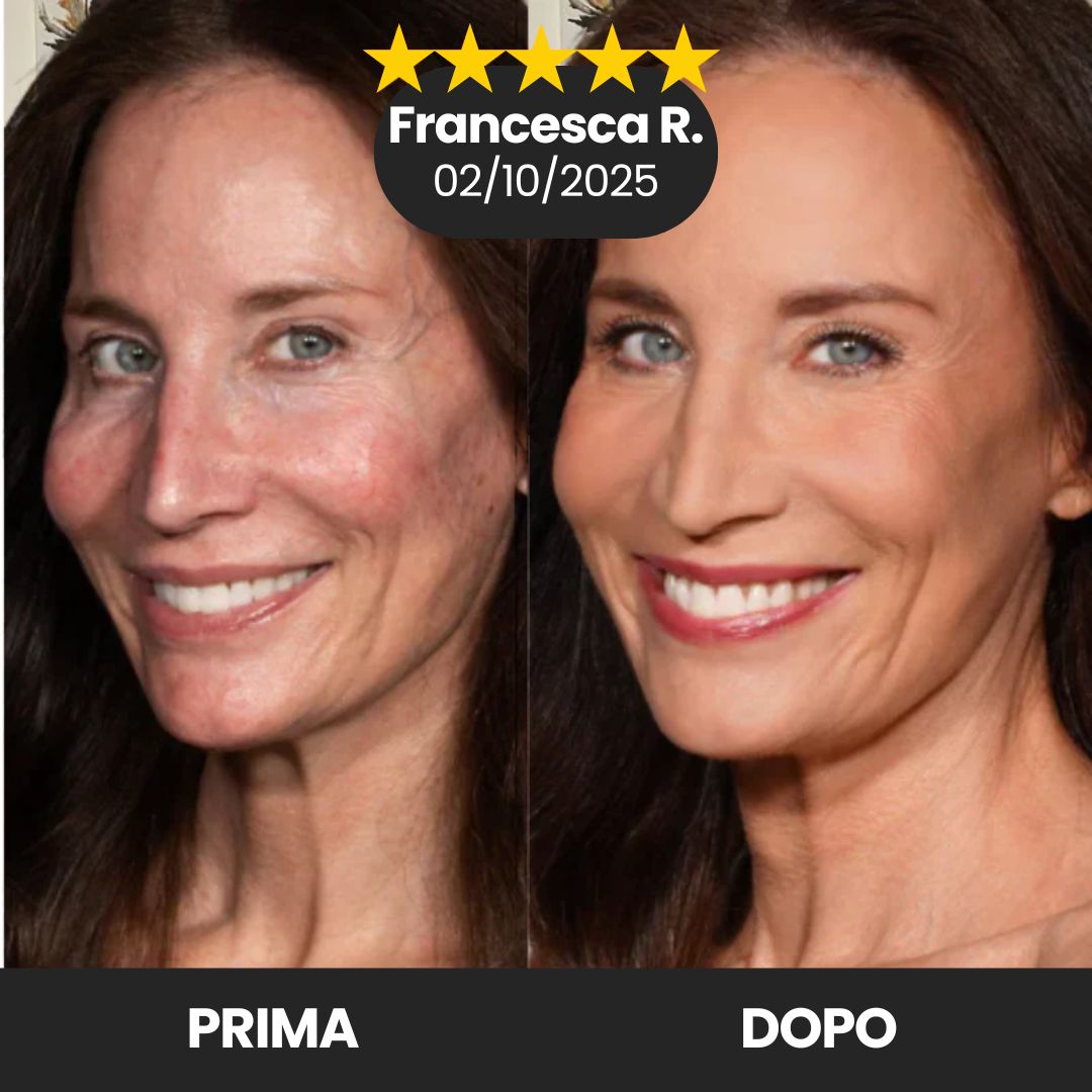  Translation missing: it.placeholder.placeholder_image_alt