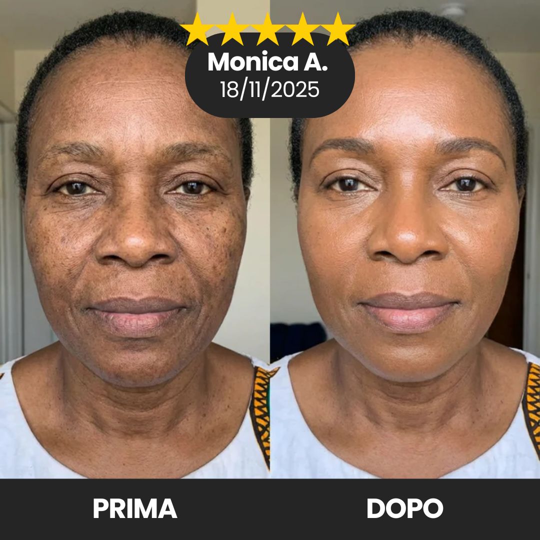  Translation missing: it.placeholder.placeholder_image_alt