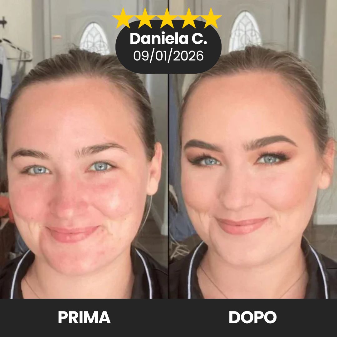  Translation missing: it.placeholder.placeholder_image_alt