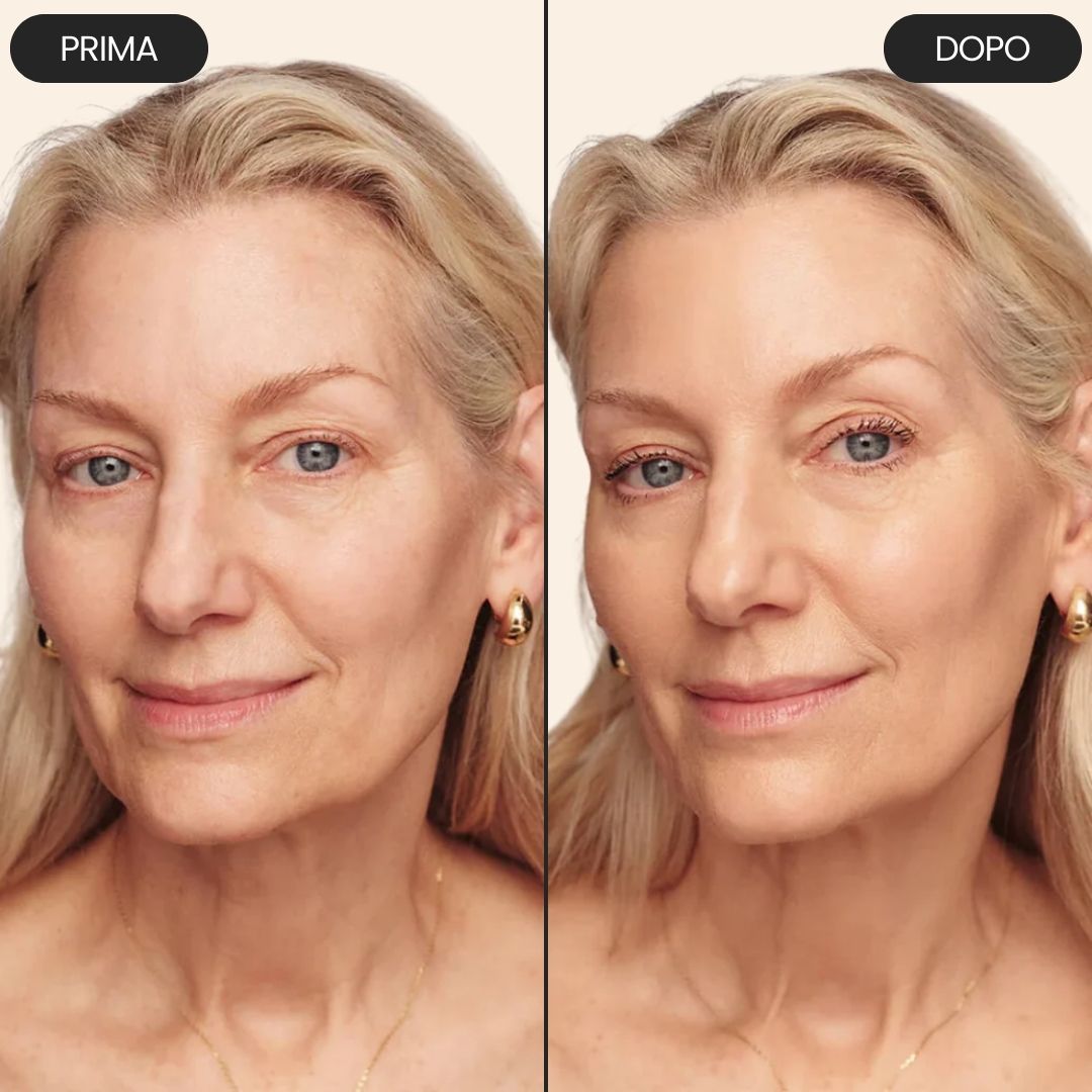  Translation missing: it.placeholder.placeholder_image_alt